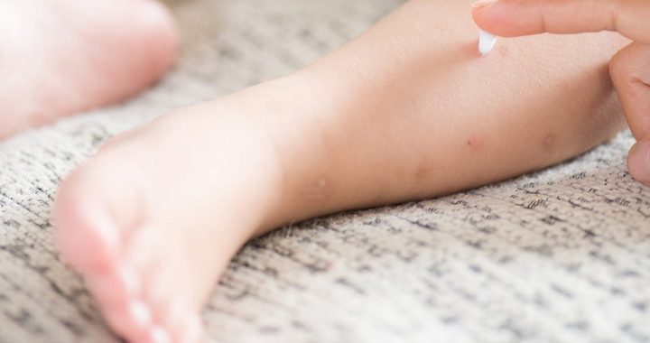 5 Cara Mengatasi Kulit Kering Pada Bayi